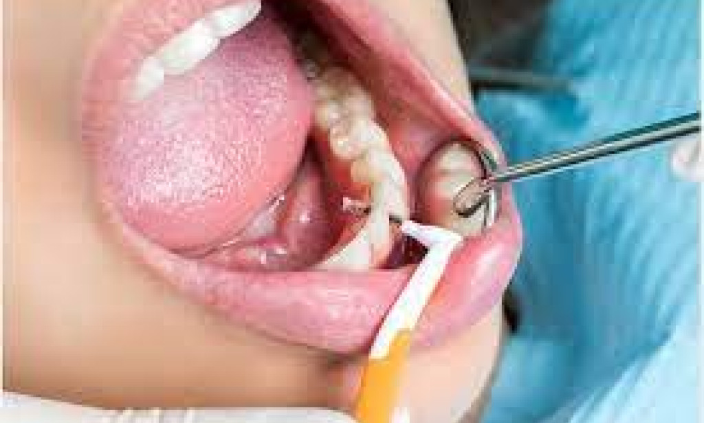 Are Your in Need of Advance Dental Care?