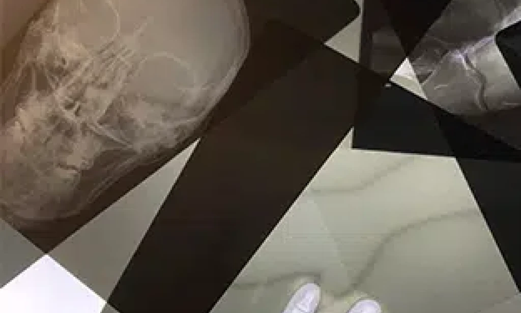 Mastering X-ray Image Disposal in Berlin: Your Definitive Guide to Environmental Consciousness and Data Protection