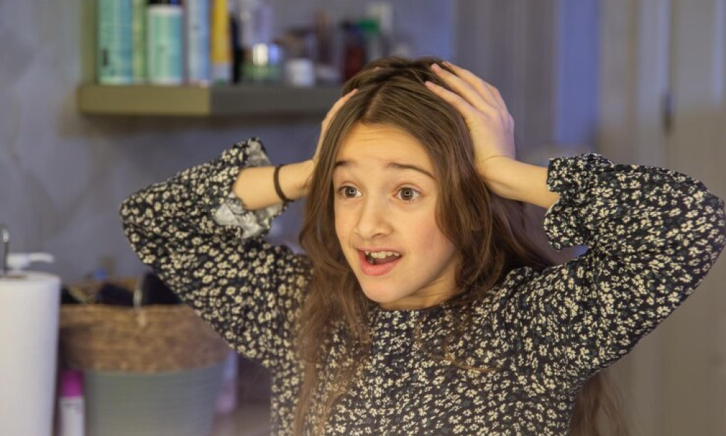 How Do You Get Rid of Dandruff Urgently?