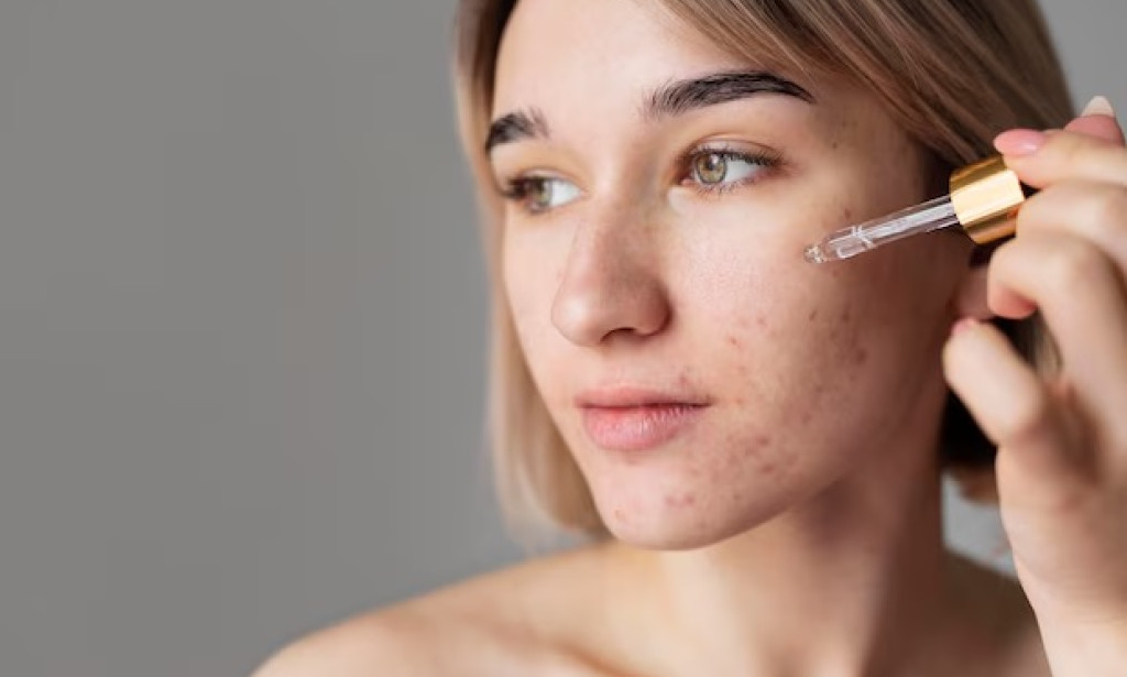 How Do You Use Acne Scar Removal Serum?