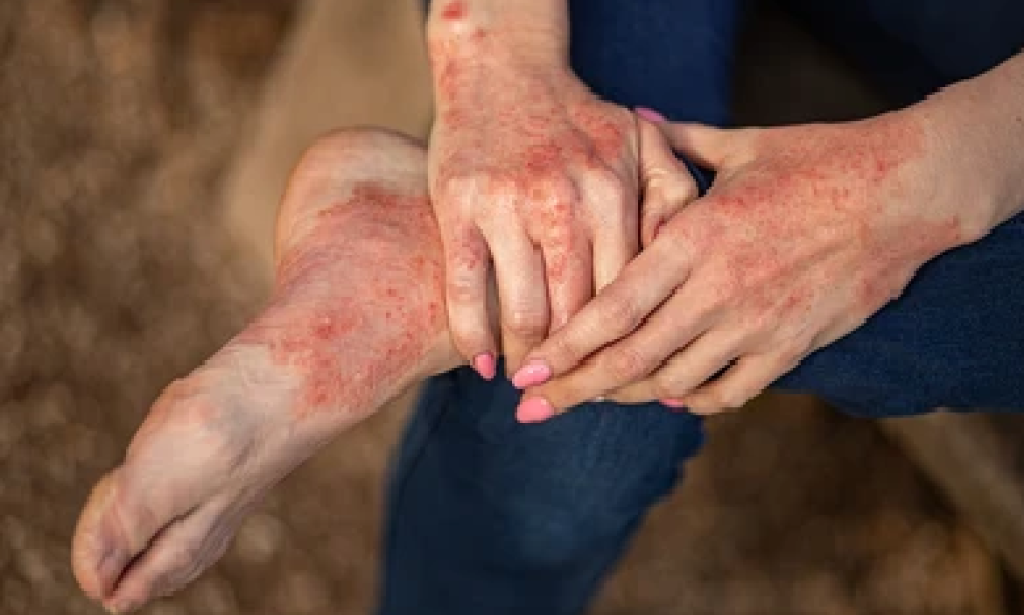 A Complete Guide to Using Ivermectin for Parasitic Infections