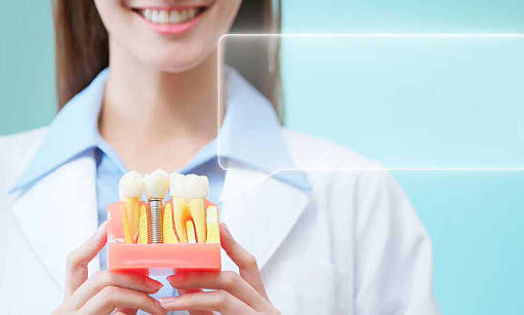 Do Dental Implants Need Special Cleaning Tools?