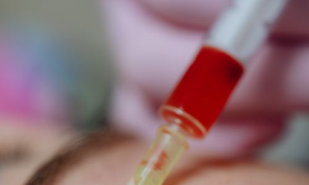 How Collagen-Stimulating Treatments Support Long-Term Skin Goals